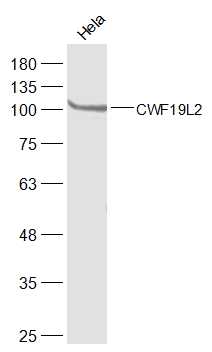 1 - CWF19L2 Rabbit pAb AP55426
