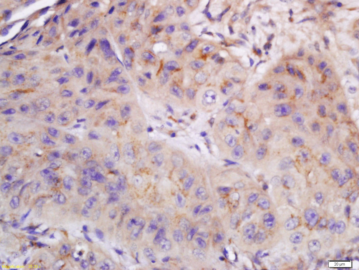 14 - CYB5R4 Rabbit pAb AP55434