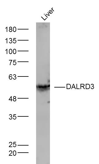 1 - DALRD3 Rabbit pAb AP55453