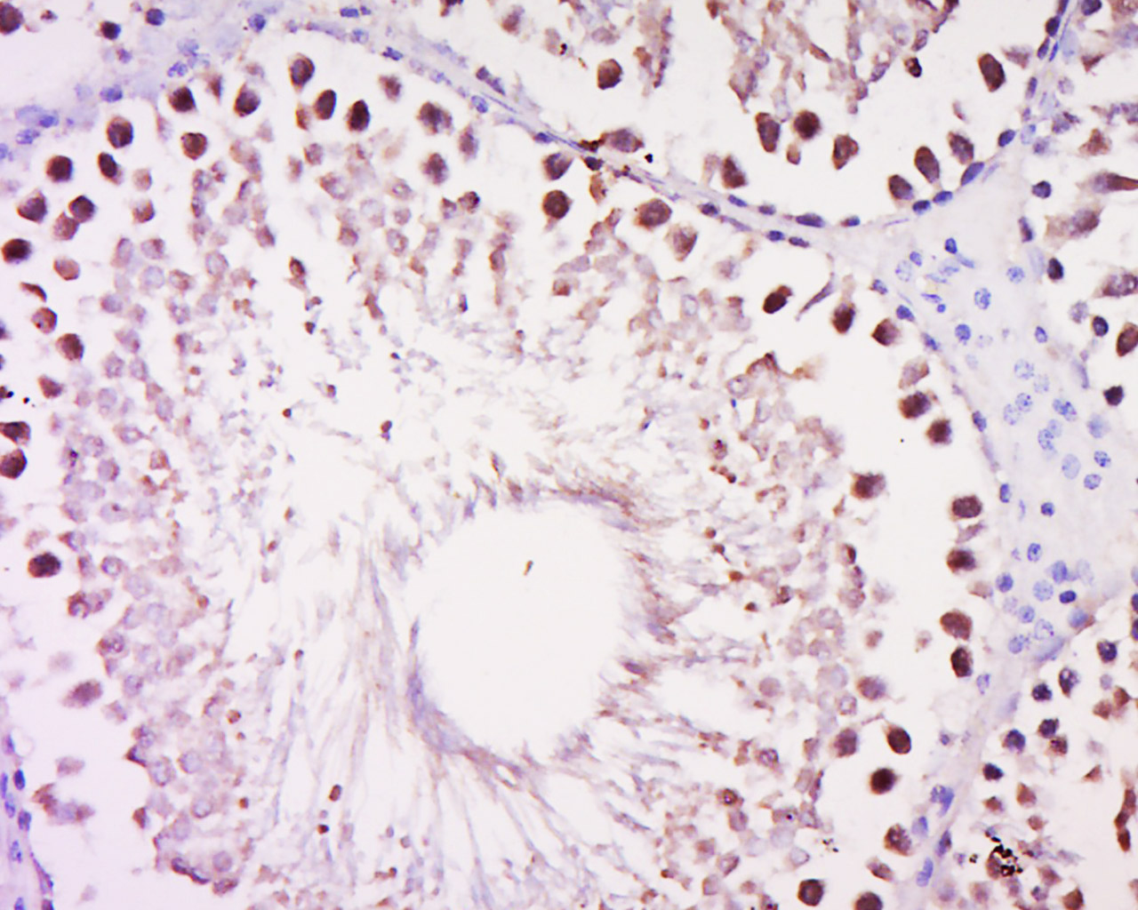 14 - DALRD3 Rabbit pAb AP55453