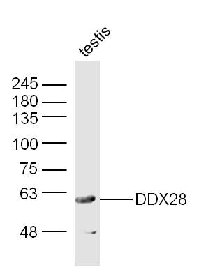 1 - DDX28 Rabbit pAb AP55470
