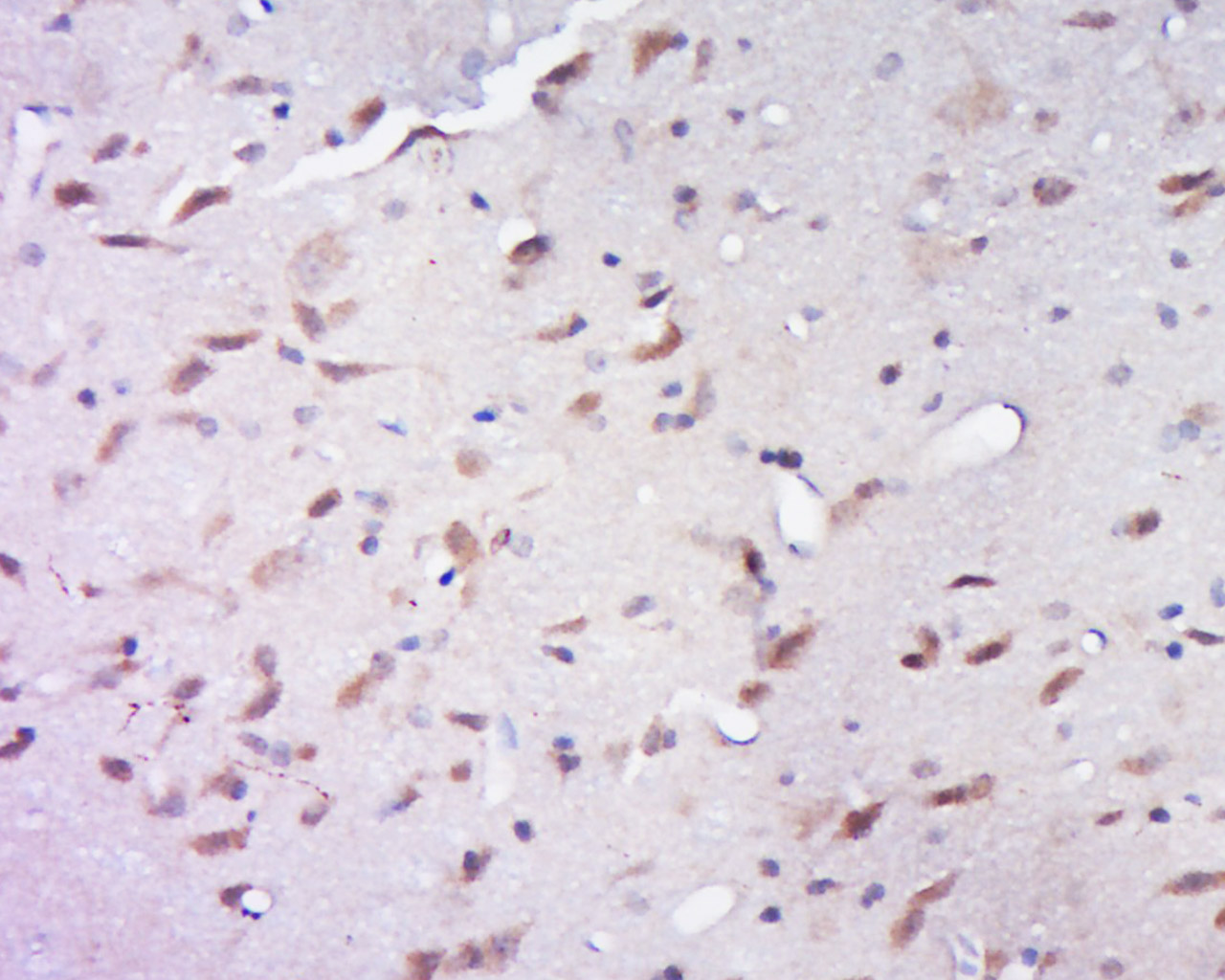 14 - DDX28 Rabbit pAb AP55470