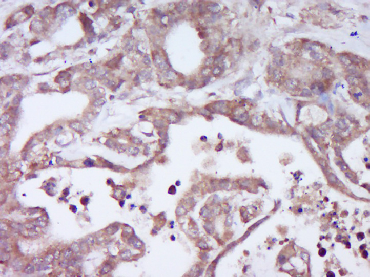 14 - DEFB109 Rabbit pAb AP55479
