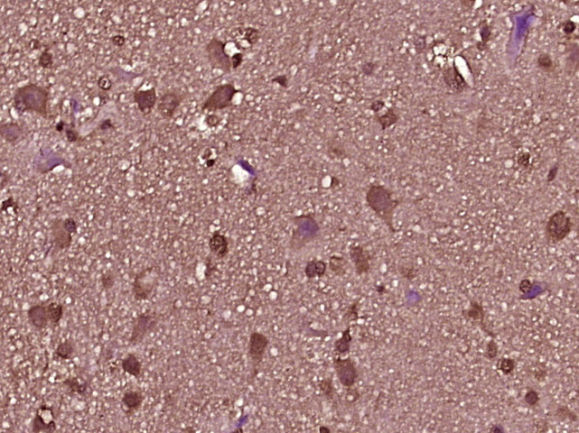 14 - DEFB124 Rabbit pAb AP55485