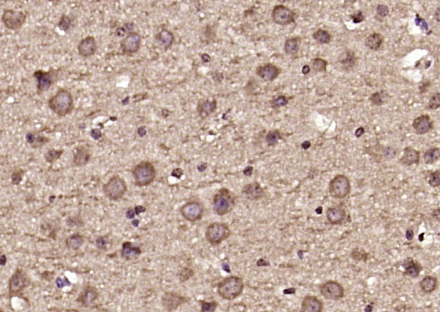 14 - DDX60 Rabbit pAb AP55486