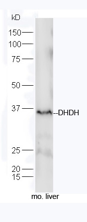 1 - DHDH Rabbit pAb AP55512