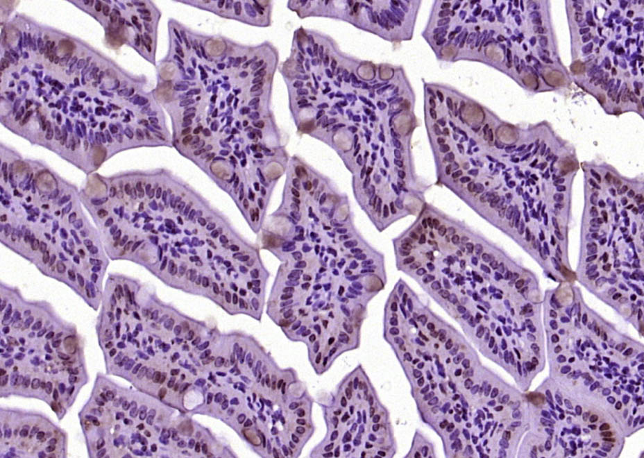 14 - DHDH Rabbit pAb AP55512
