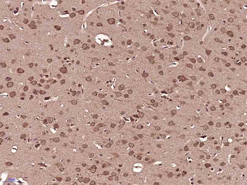14 - DIP2B Rabbit pAb AP55526
