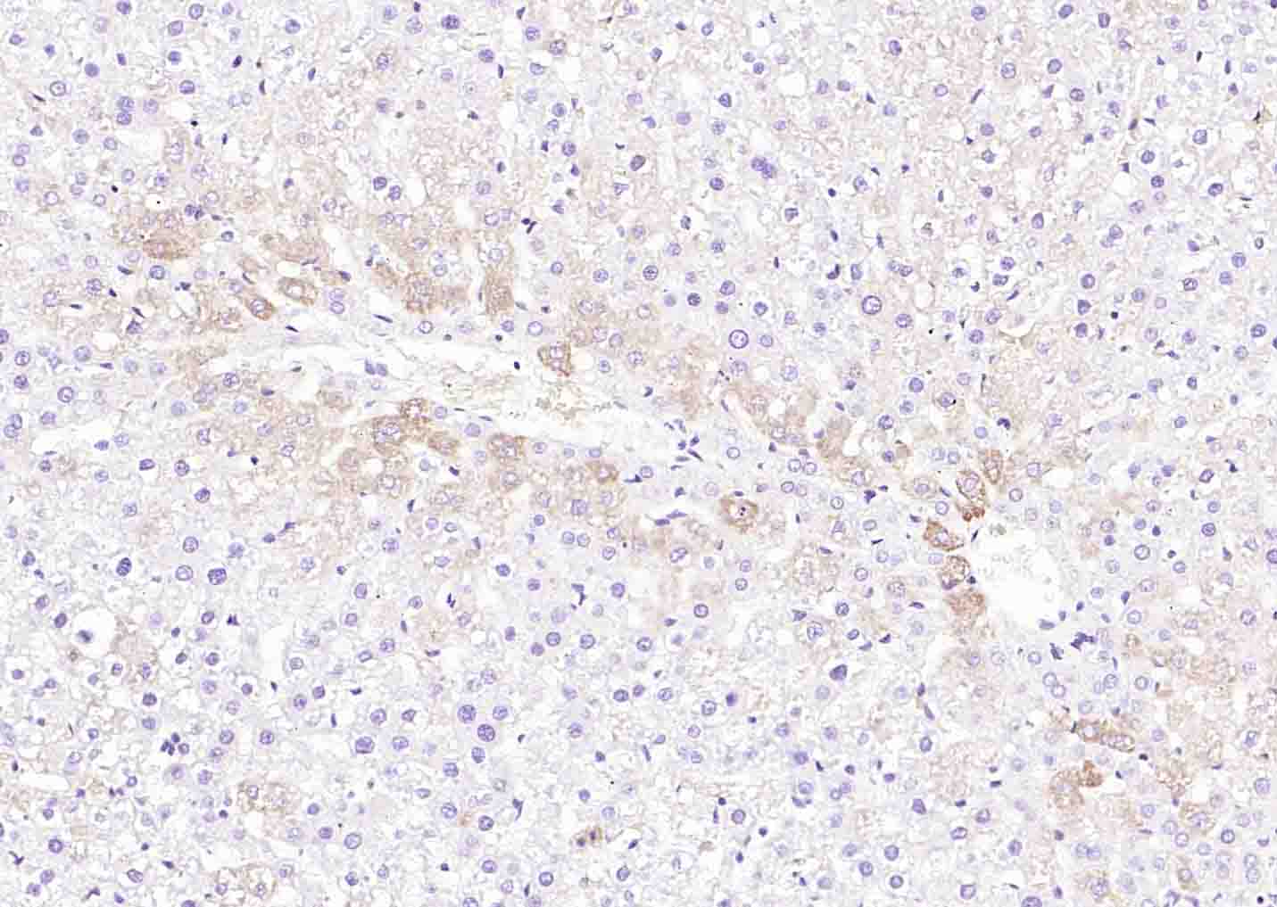 14 - DNAH1 Rabbit pAb AP55537