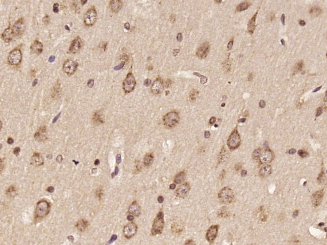 14 - DNAH6 Rabbit pAb AP55540