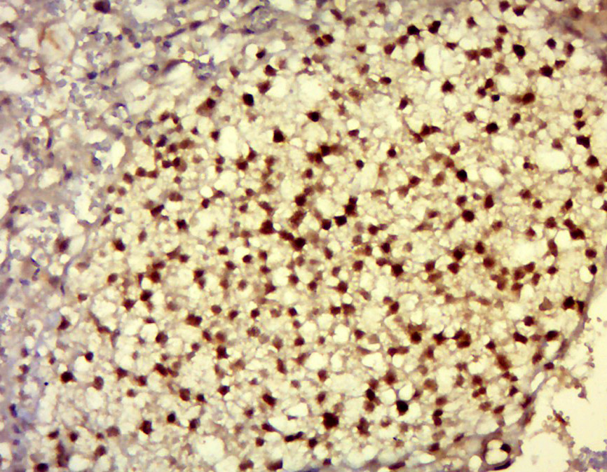 14 - DNAJC21 Rabbit pAb AP55553