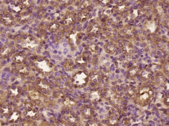 14 - DOC2B Rabbit pAb AP55559