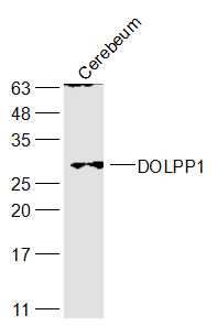 1 - DOLPP1 Rabbit pAb AP55561