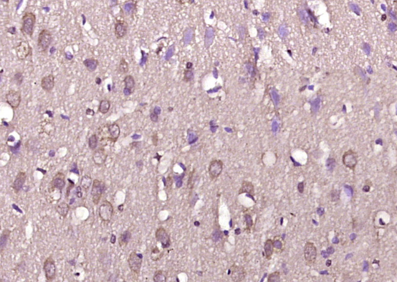 14 - DOPEY1 Rabbit pAb AP55562