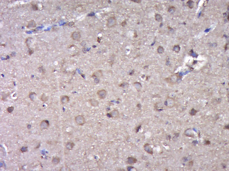 14 - DOPEY2 Rabbit pAb AP55563