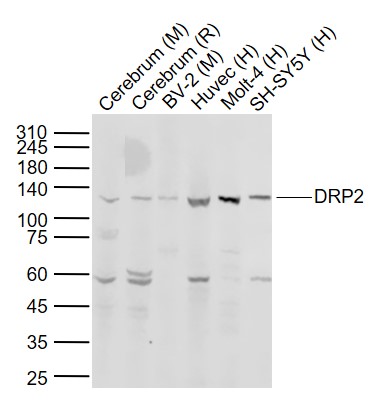 1 - DRP2 Rabbit pAb AP55571