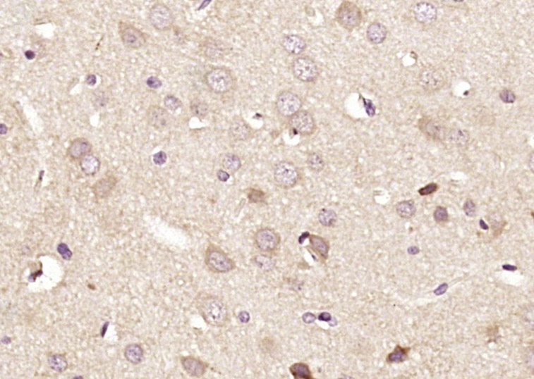 14 - DRP2 Rabbit pAb AP55571