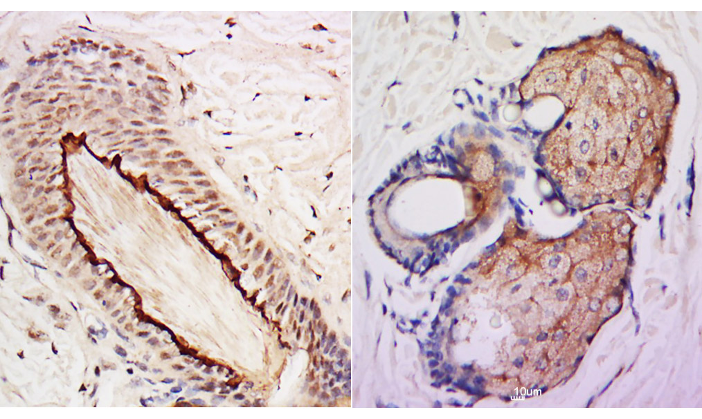 14 - DSS1 Rabbit pAb AP55574