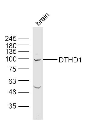 1 - DTHD1 Rabbit pAb AP55576