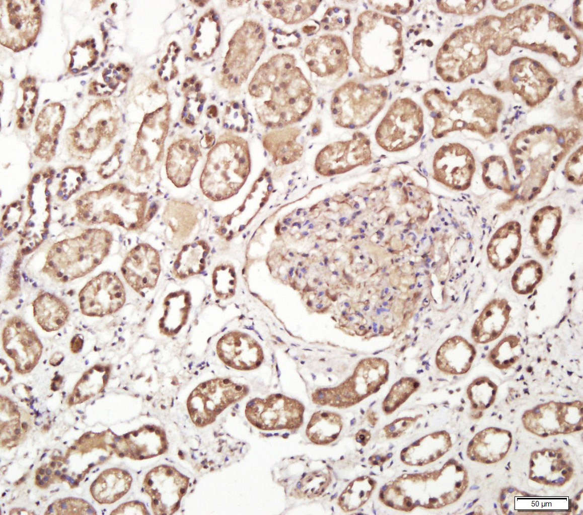 14 - DTHD1 Rabbit pAb AP55576