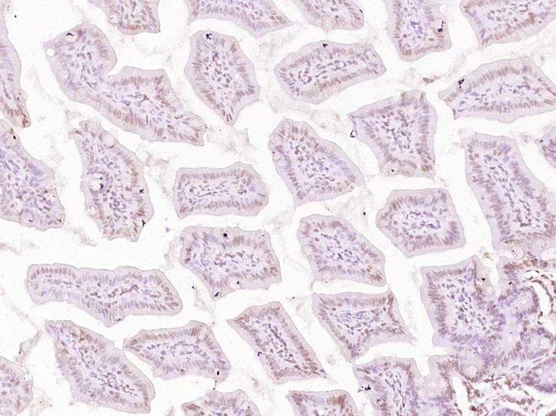 14 - ESCO2 Rabbit pAb AP55652