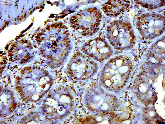 14 - EXOC6B Rabbit pAb AP55663