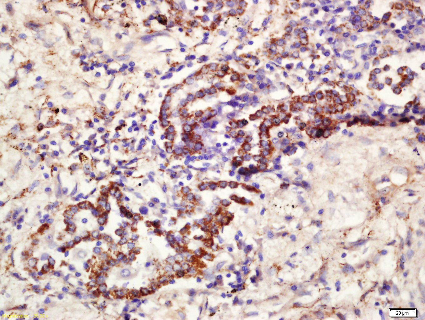14 - CD361 Rabbit pAb AP55672