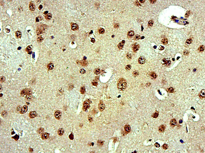 14 - FAM193B Rabbit pAb AP55713