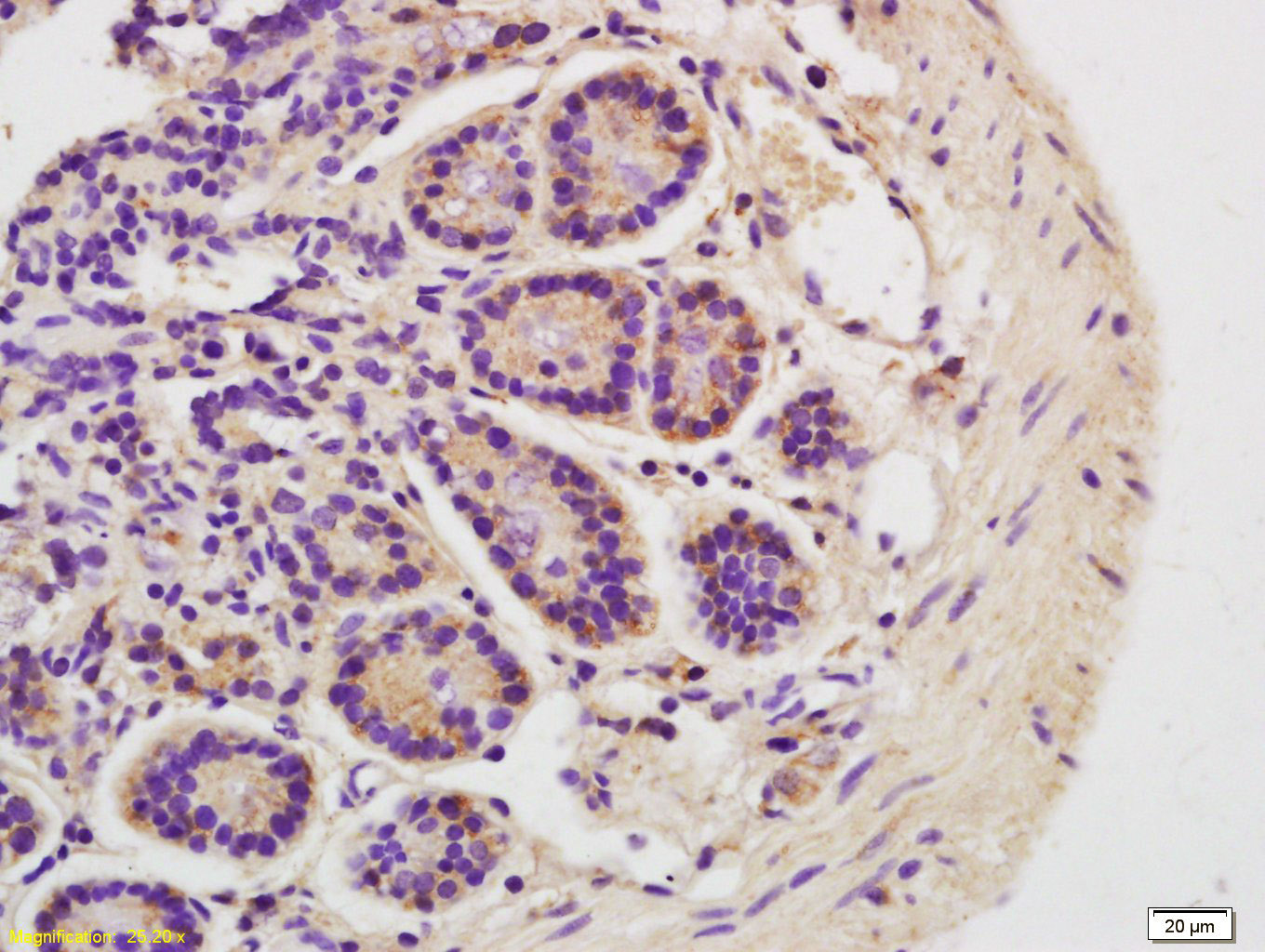 14 - FAM210B Rabbit pAb AP55720