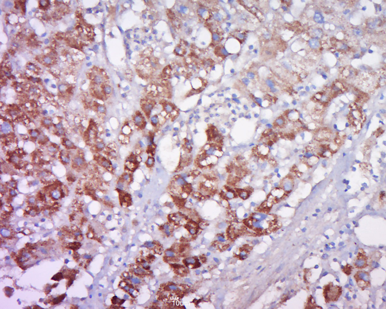 14 - FAM47A Rabbit pAb AP55730
