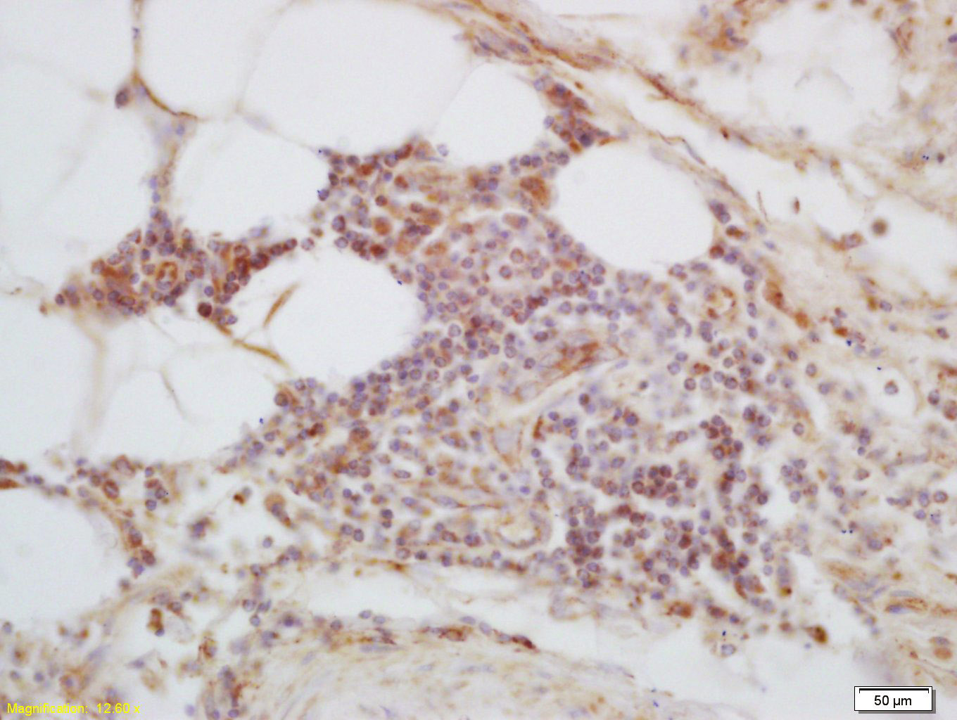 14 - C1orf106 Rabbit pAb AP55734