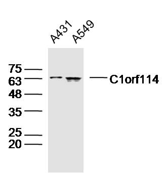 1 - C1orf114 Rabbit pAb AP55738