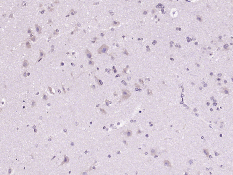 14 - C1orf156 Rabbit pAb AP55749