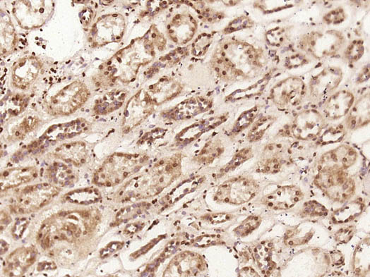 14 - C1orf200 Rabbit pAb AP55764