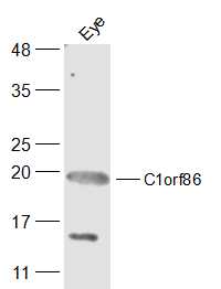 1 - C1orf86 Rabbit pAb AP55783