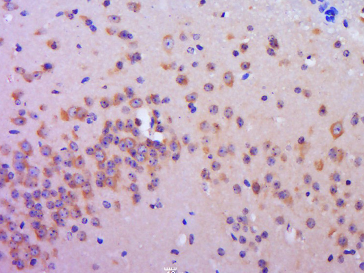 14 - C20orf94 Rabbit pAb AP55811