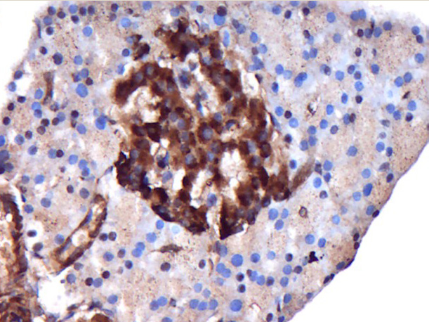 14 - MAP3K7CL Rabbit pAb AP55816