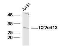 1 - C22orf13 Rabbit pAb AP55818