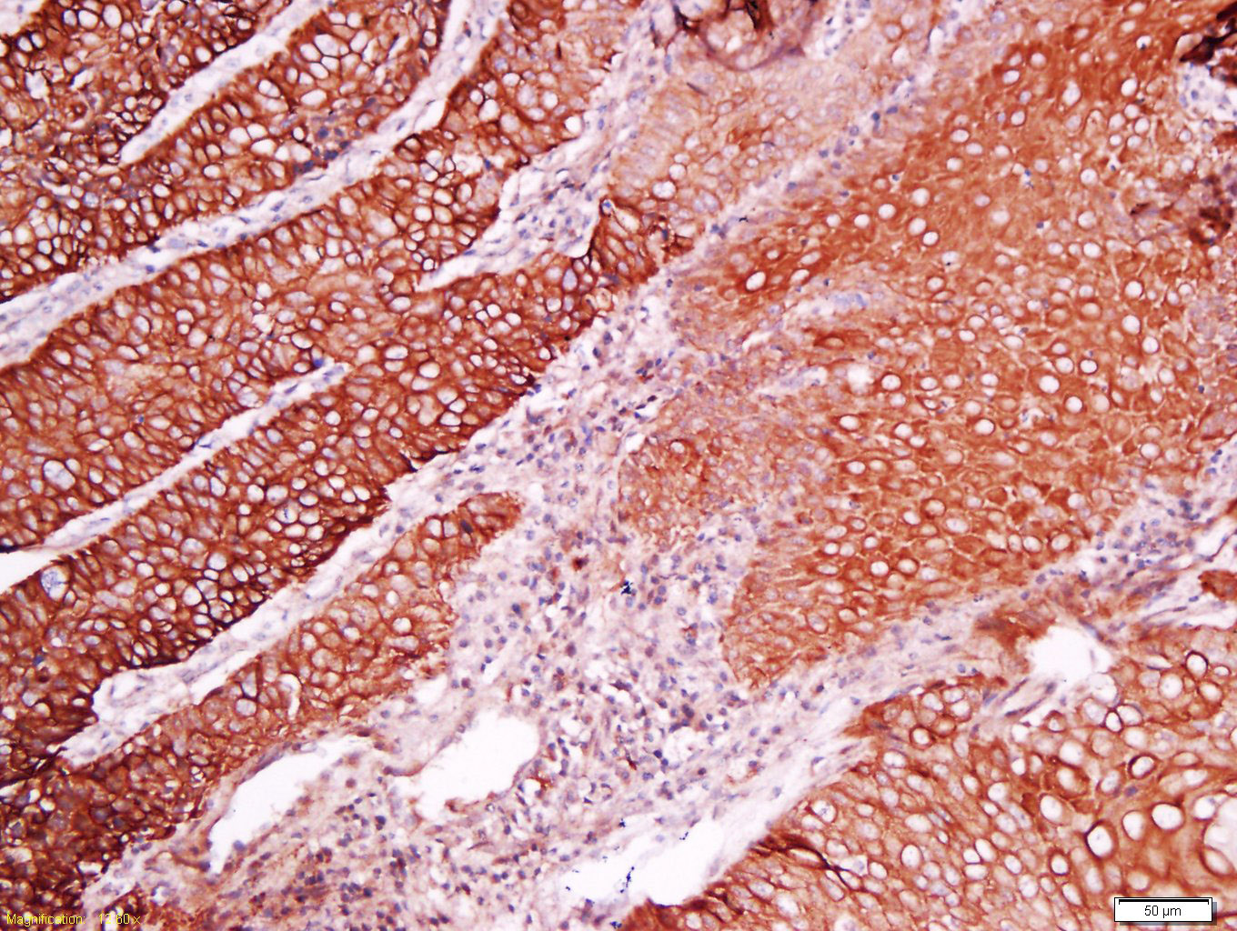 14 - C2orf16 Rabbit pAb AP55829