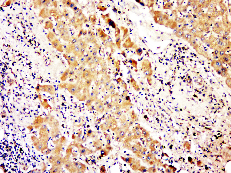 14 - C2orf65 Rabbit pAb AP55835