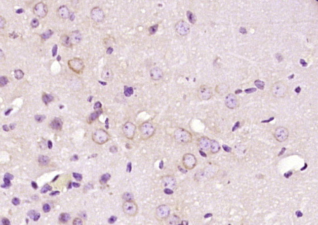 14 - C2orf76 Rabbit pAb AP55838