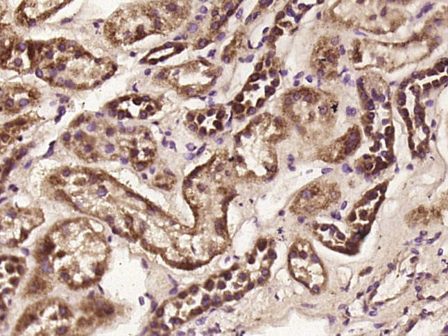 14 - C3orf55 Rabbit pAb AP55853