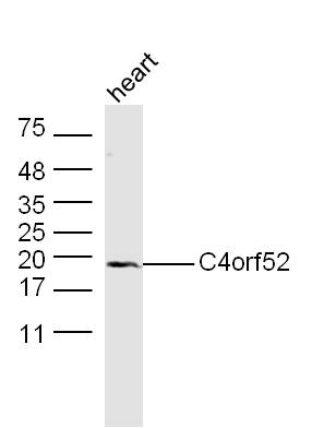 1 - C4orf52 Rabbit pAb AP55863