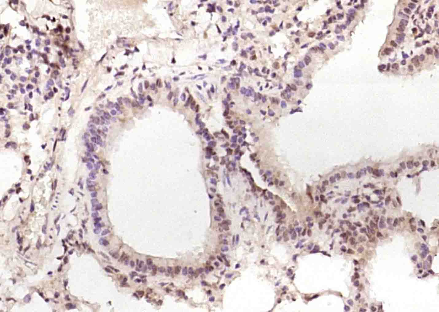 14 - C6orf201 Rabbit pAb AP55888