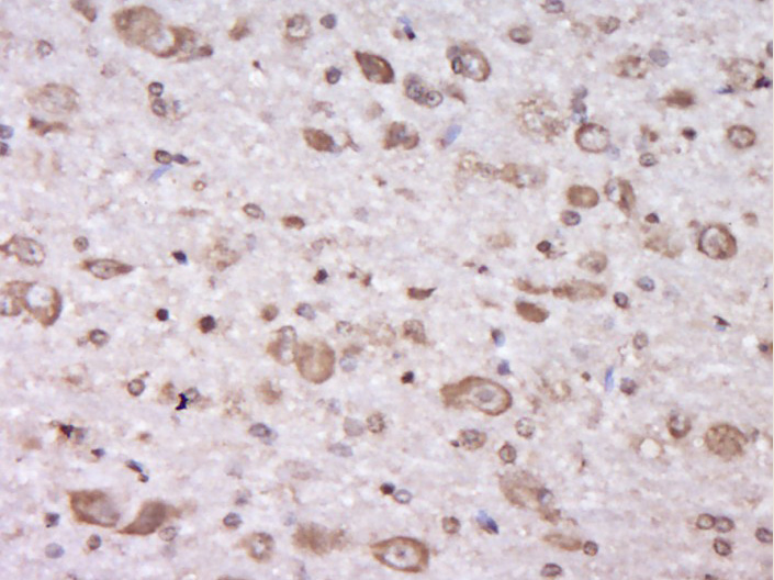 14 - C6orf203 Rabbit pAb AP55889