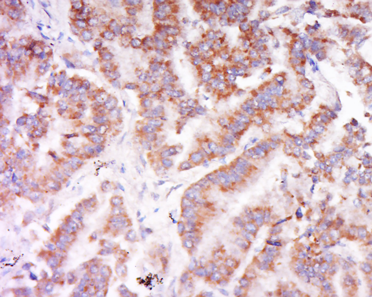 14 - C6orf222 Rabbit pAb AP55892