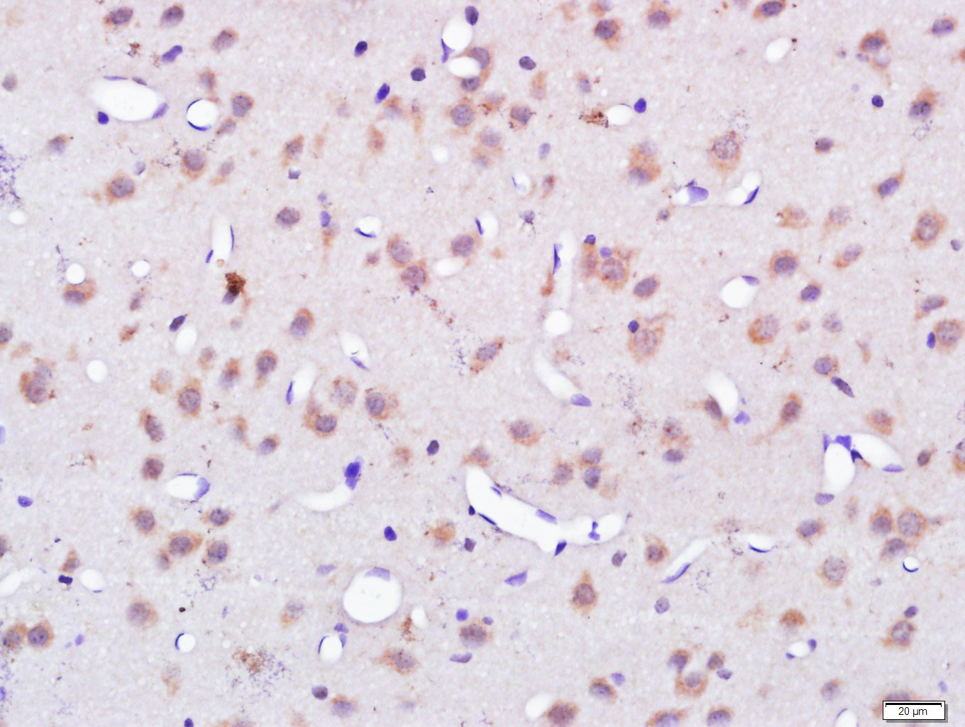 14 - C7orf16 Rabbit pAb AP55905