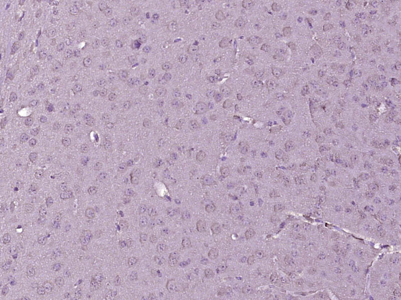 14 - C7orf59 Rabbit pAb AP55915