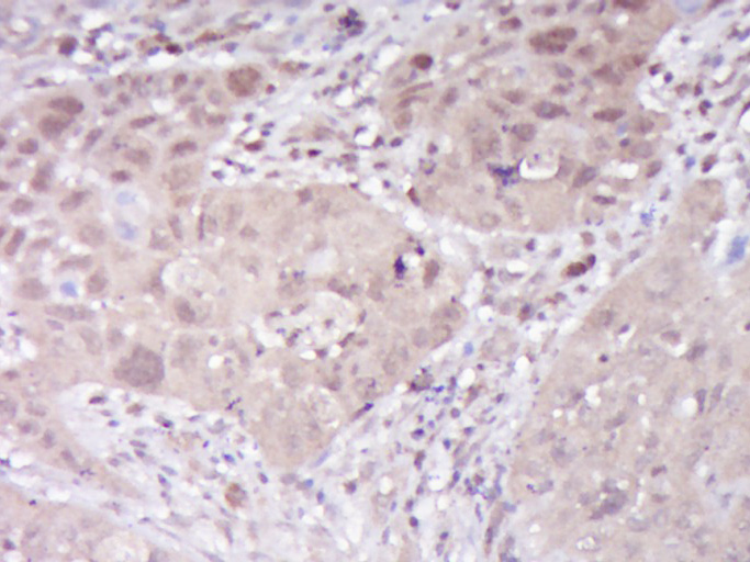 14 - C7orf65 Rabbit pAb AP55917