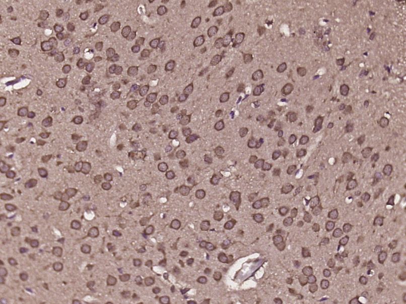 14 - C8orf84 Rabbit pAb AP55934